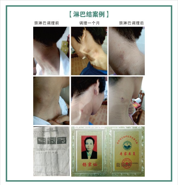 大国医者 国医名师  优秀中医传承人——杨宗仙