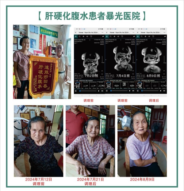 大国医者 国医名师  优秀中医传承人——杨宗仙