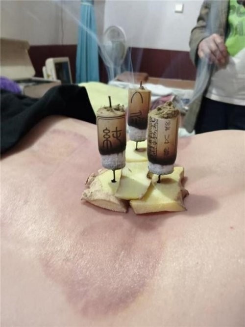 【聚焦两会·健康中国】高谷良：以仁心仁术书写中医药传承创新答卷