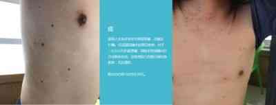 大国医者 国医名师——宁永球